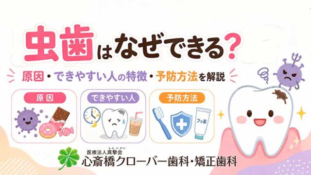 虫歯はなぜできる?原因・できやすい人の特徴・予防方法を解説