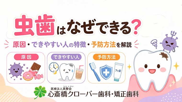 虫歯はなぜできる?原因・できやすい人の特徴・予防方法を解説