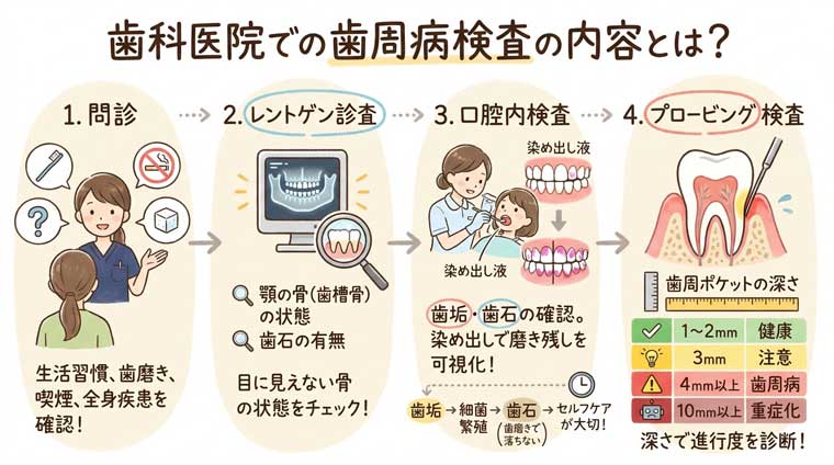 歯科医院での歯周病検査の内容とは？の図解