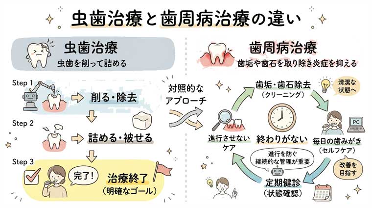 虫歯と歯周病の違いの図解