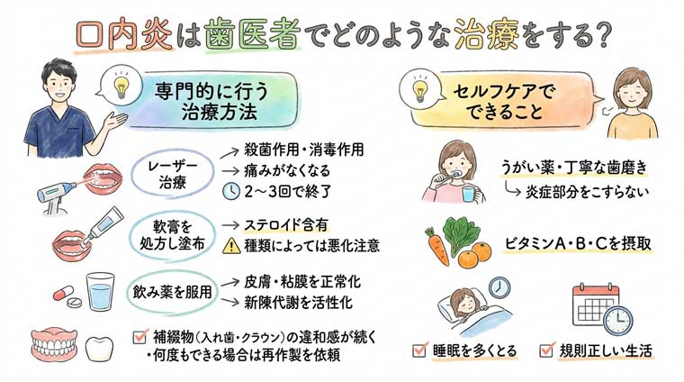 口内炎は歯医者でどのような治療をする？の図解