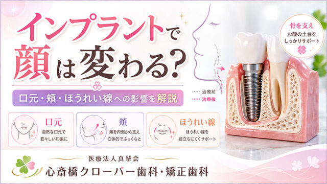 インプラントで顔は変わる?口元・頬・ほうれい線への影響を解説