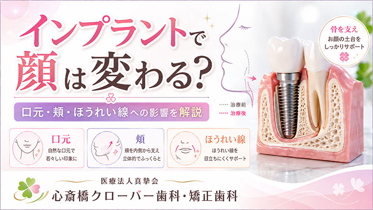 インプラントで顔は変わる?口元・頬・ほうれい線への影響を解説