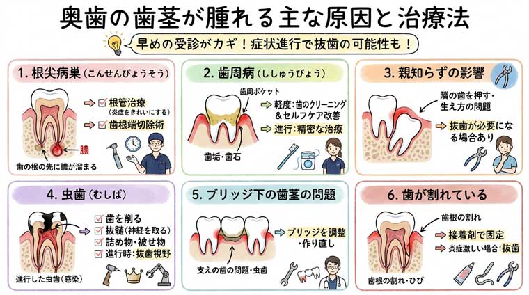 奥歯の歯茎が腫れる主な原因と治療法の図解