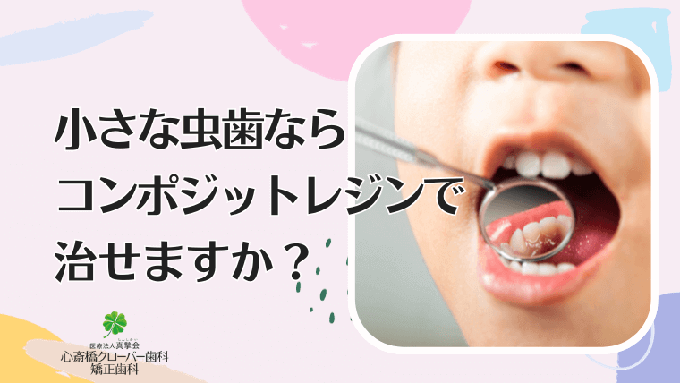 小さな虫歯ならコンポジットレジンで治せますか？