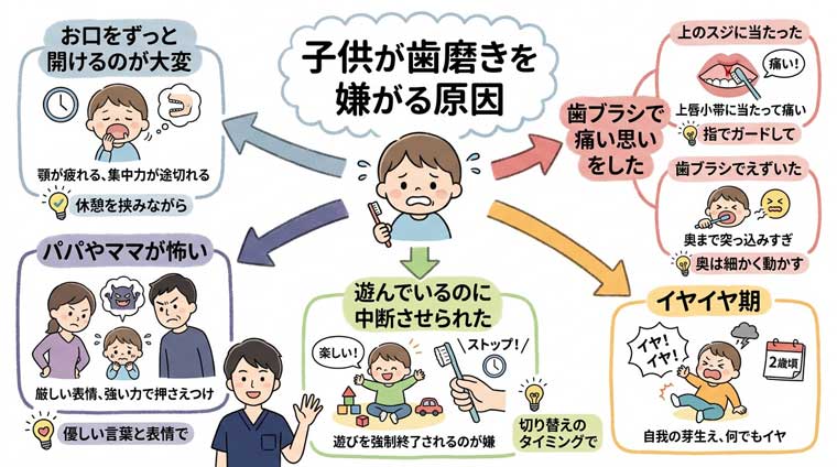 子供が歯磨きを嫌がる原因の図解