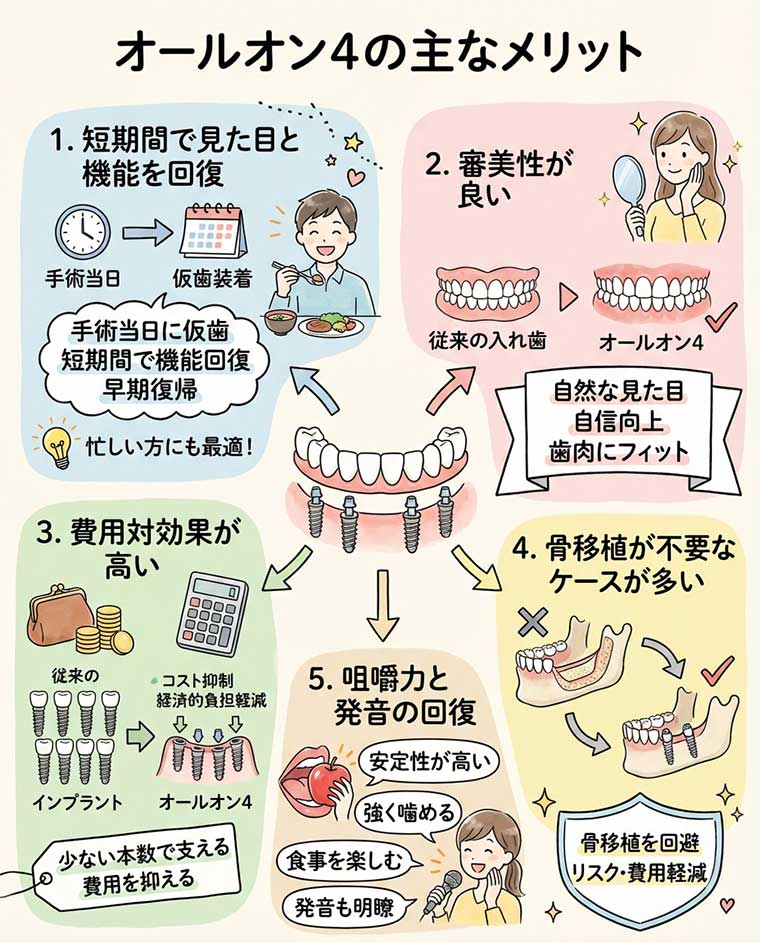 オールオン4の主なメリット