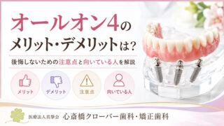 オールオン4のメリット・デメリットは？後悔しないための注意点と向いている人を解説