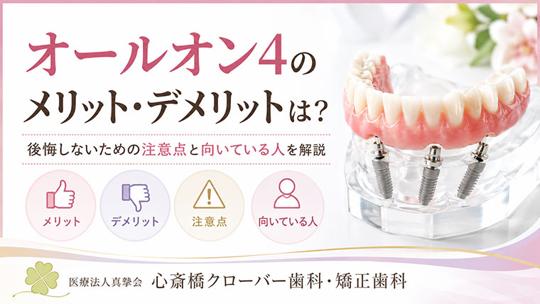 オールオン4のメリット・デメリットは?後悔しないための注意点と向いている人を解説