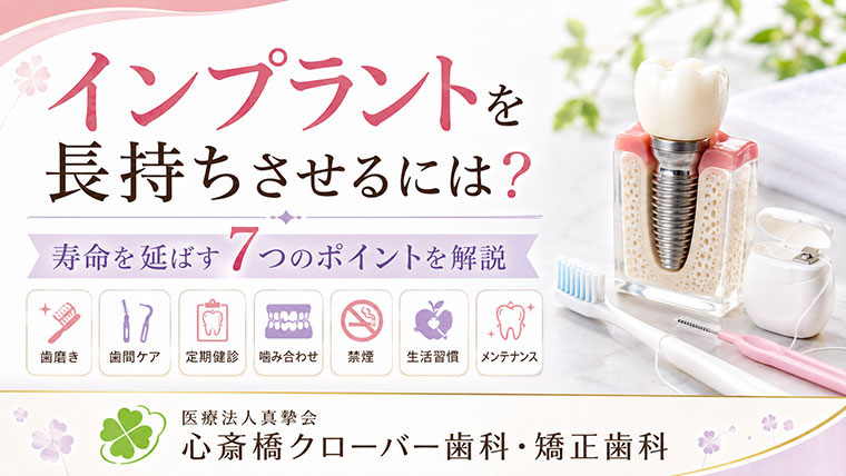 インプラントを長持ちさせるには？寿命を延ばす7つのポイントを解説