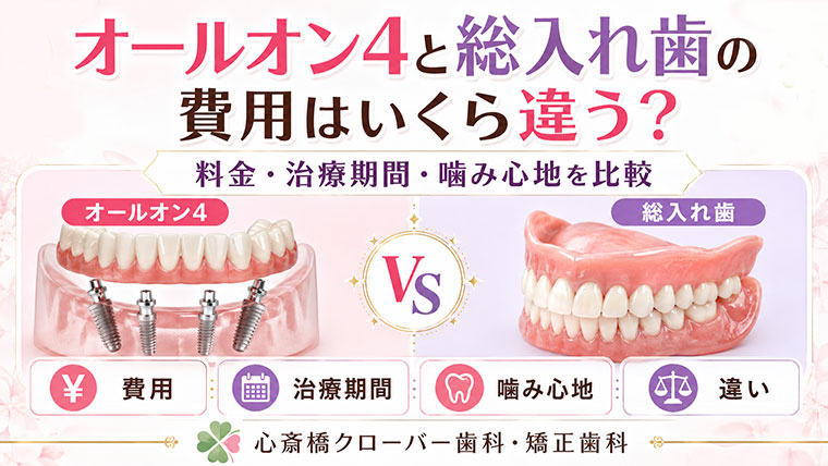 オールオン4と総入れ歯の費用はいくら違う？料金・治療期間・噛み心地