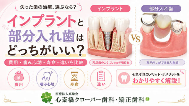 インプラントと部分入れ歯はどっちがいい?費用・噛み心地・寿命・違いを比較