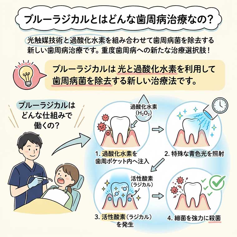 ブルーラジカルとはどんな歯周病治療なの？の図解
