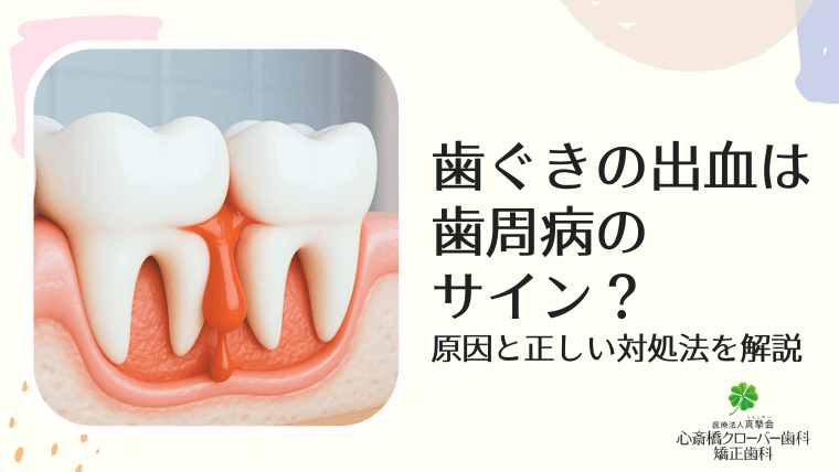 歯ぐきの出血は歯周病のサイン？原因と正しい対処法を解説