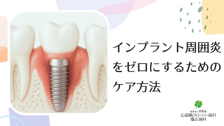 インプラント周囲炎をゼロにするためのケア方法