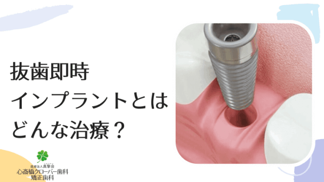 抜歯即時インプラントとはどんな治療？