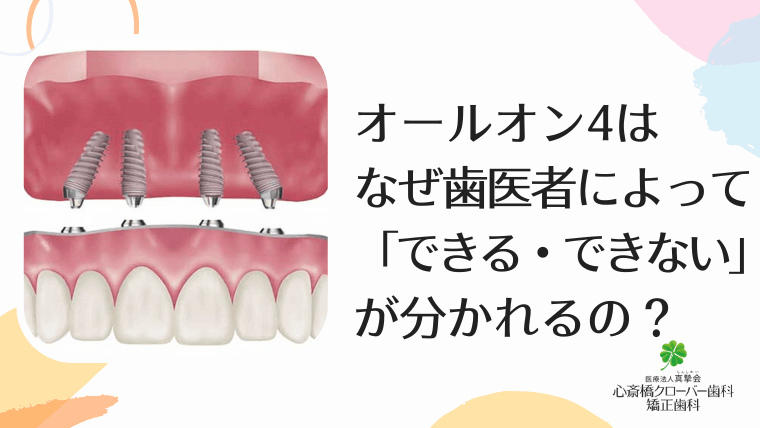 オールオン4はなぜ歯医者によって「できる・できない」が分かれるの？