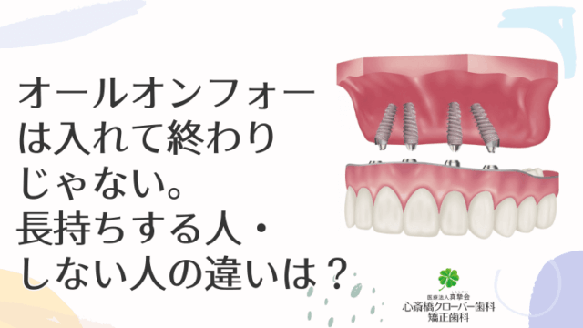 オールオンフォーは入れて終わりじゃない。長持ちする人・しない人の違いは？