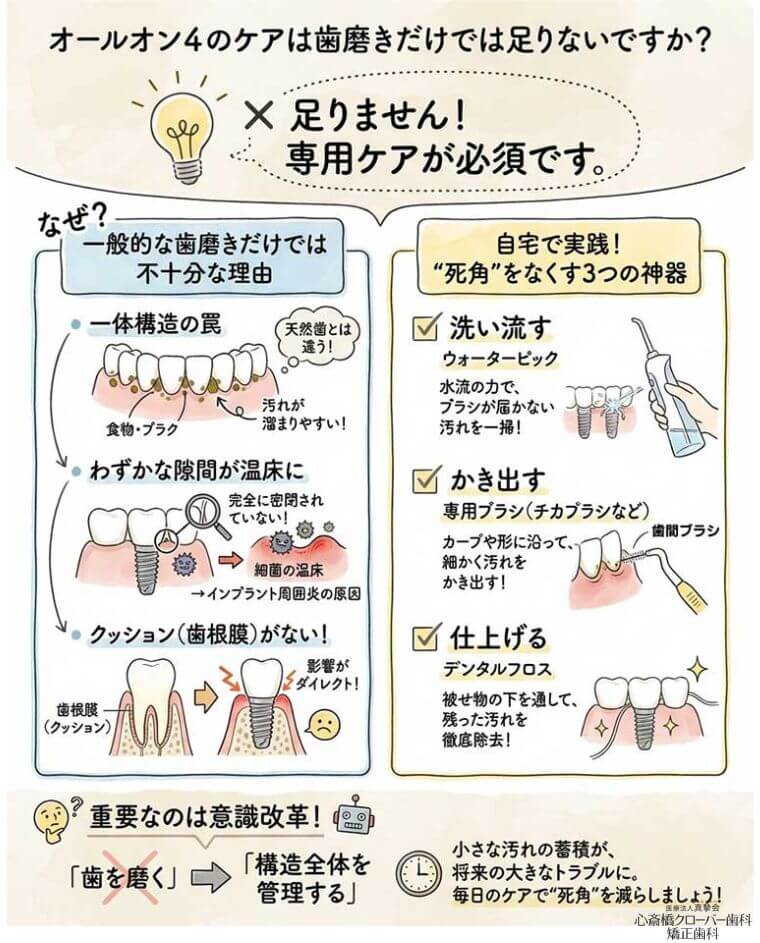 オールオン4のケアは歯磨きだけでは足りないですか？