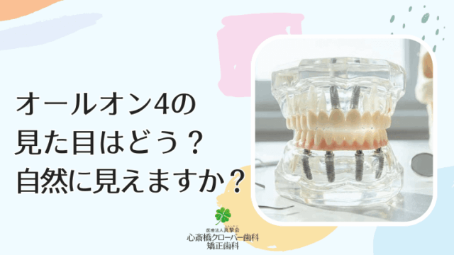 オールオン4の見た目はどう？自然に見えますか？