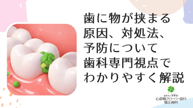 歯に物が挟まる原因、対処法、予防について歯科専門視点でわかりやすく解説
