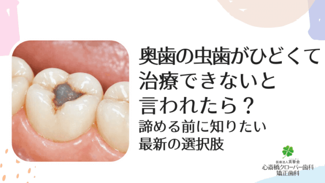 奥歯の虫歯がひどくて治療できないと言われたら？諦める前に知りたい最新の選択肢