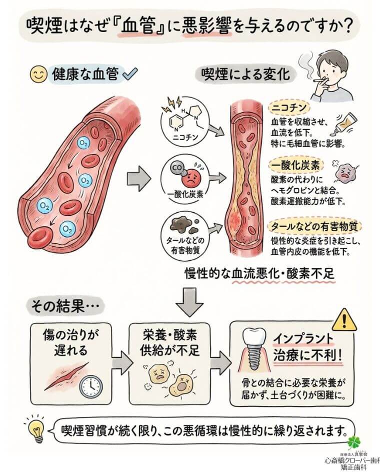 喫煙はなぜ「血管」に悪影響を与えるのですか？