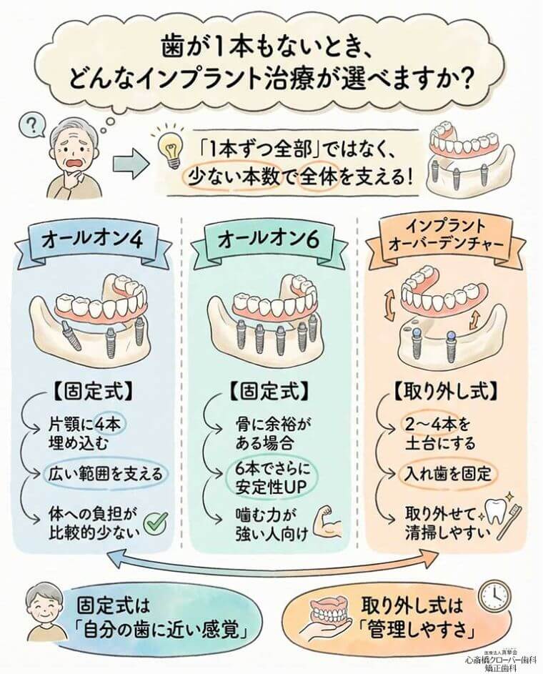 歯が1本もないとき、どんなインプラント治療が選べますか？の図解