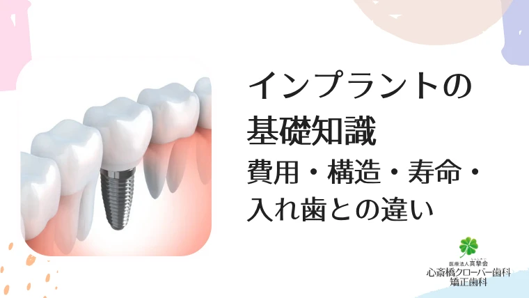 インプラントの基礎知識｜費用・構造・寿命・入れ歯との違い