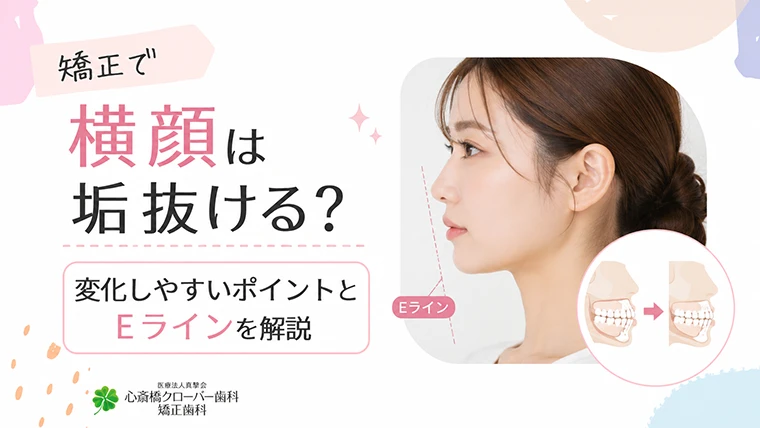 矯正で横顔は垢抜ける?変化しやすいポイントとEラインを解説