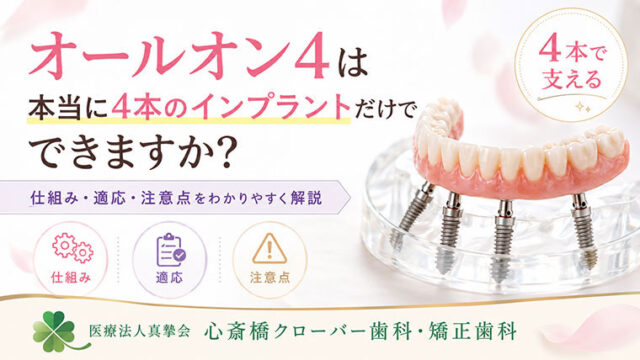 オールオン4は本当に4本のインプラントだけでできますか？