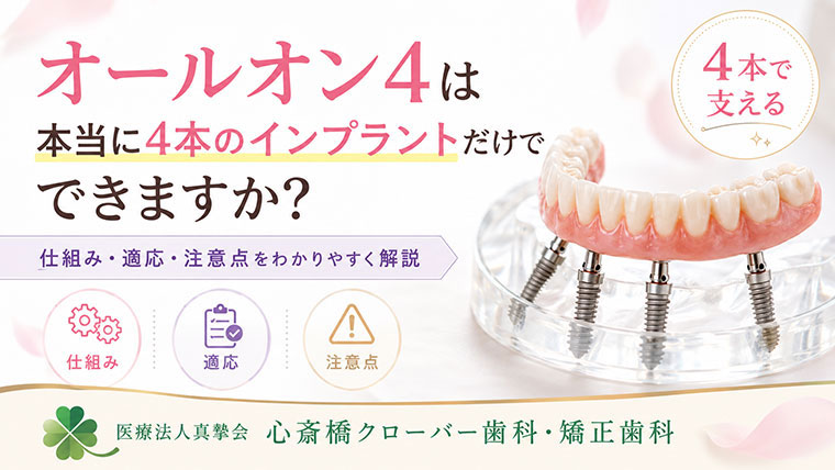 オールオン4は本当に4本のインプラントだけでできますか?