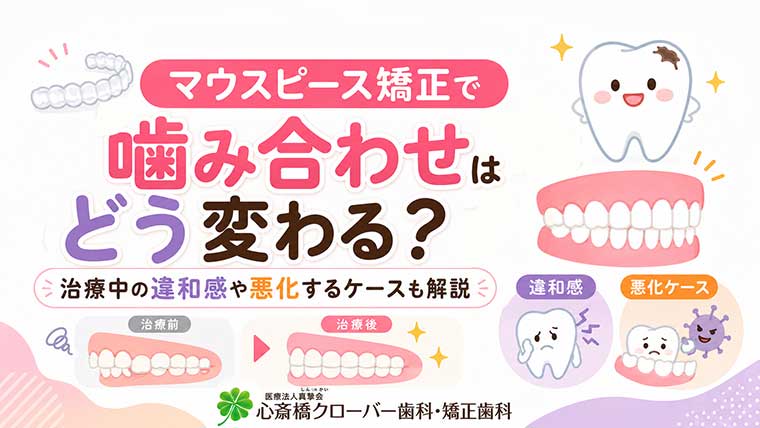 マウスピース矯正で噛み合わせはどう変わる？治療中の違和感や悪化するケースも解説