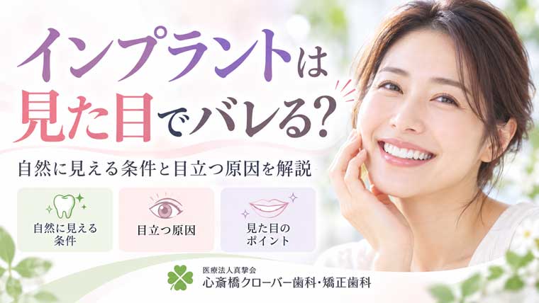 インプラントは見た目でバレる?自然に見える条件と目立つ原因を解説