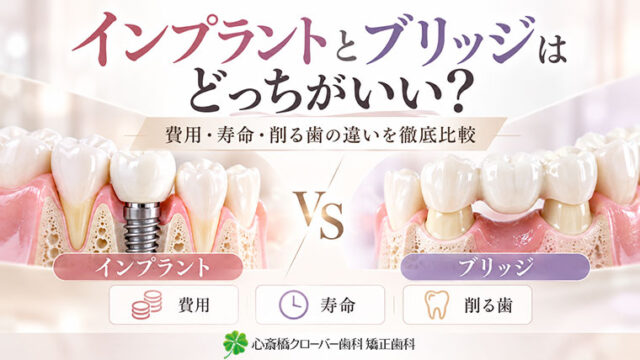 インプラントとブリッジはどっちがいい？費用・寿命・削る歯の違いを徹底比較