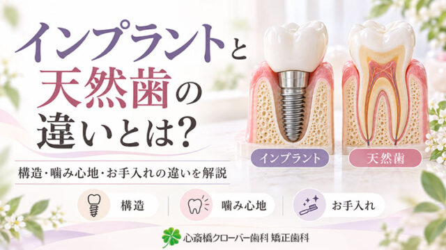 インプラントと天然歯の違いとは?構造・噛み心地・お手入れの違いを解説